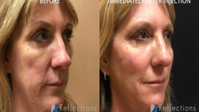 Liqefy Serum: Unlock Radiant Skin with Proven Results