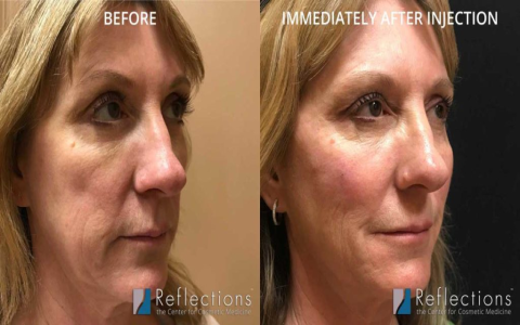 Liqefy Serum: Unlock Radiant Skin with Proven Results
