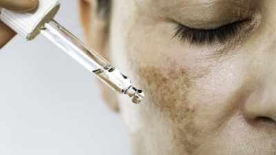Best Serum for Underarms to Lighten Dark Spots Quickly