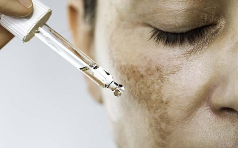 Best Serum for Underarms to Lighten Dark Spots Quickly