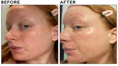 Korean Niacinamide Serum: Best Picks for Glowing Skin