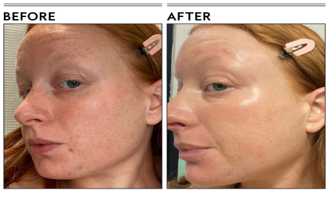 Korean Niacinamide Serum: Best Picks for Glowing Skin
