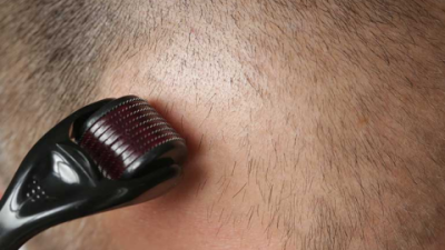 Hair Growth Microneedling Serum That Really Works