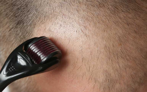Hair Growth Microneedling Serum That Really Works