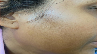 Best Circadien Serum for Youthful, Glowing Skin Overnight: The Ultimate Guide