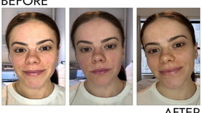 Best Organic Serum for Radiant Skin in 2025: Your Ultimate Guide to Glowing, Healthy Skin