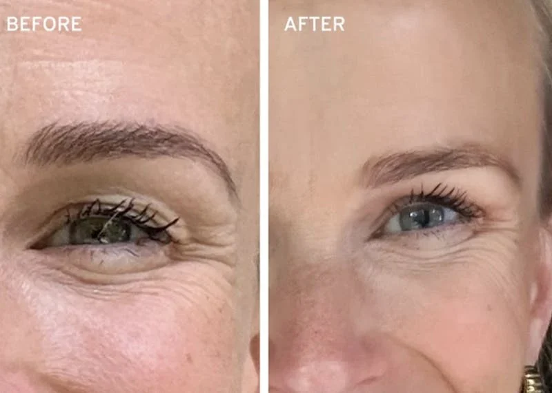 Discover Oliveta Serum: Glow & Renew Your Skin Today