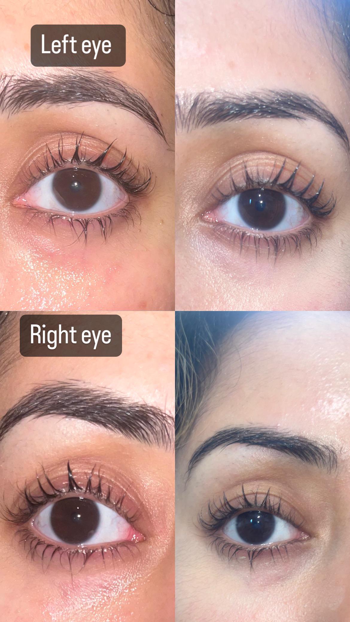 Before and After Eyelash Serum: Stunning Results You Must See