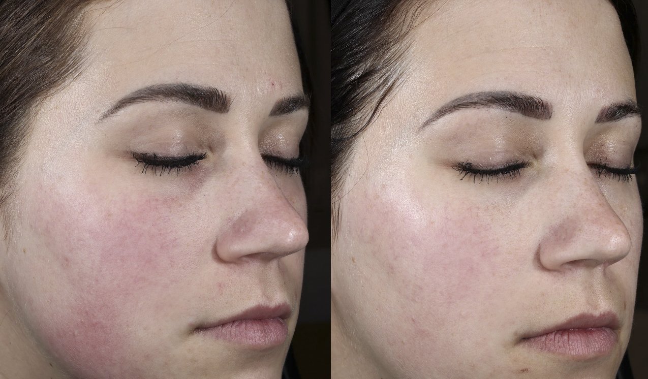 Plated Daily Serum Reviews: Does It Really Work?