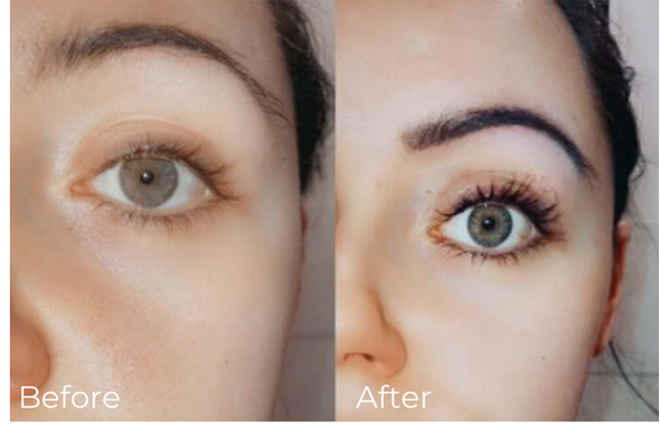 Before and After Eyelash Serum: Stunning Results You Must See