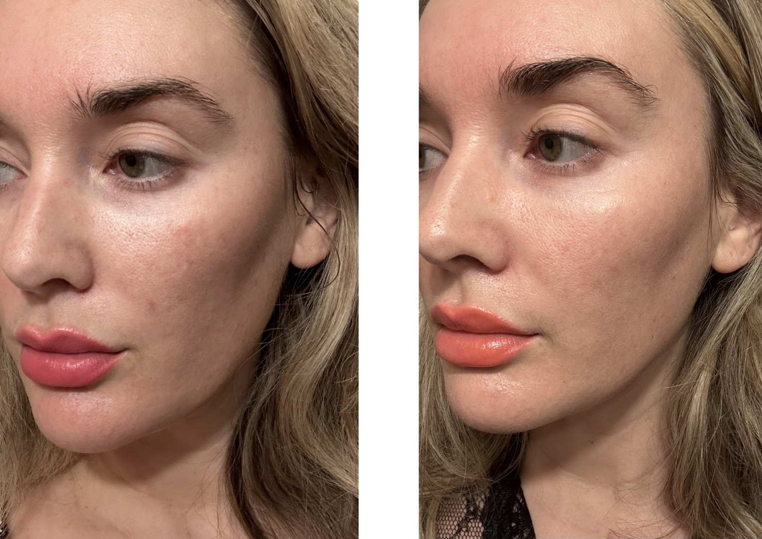 Plated Daily Serum Reviews: Does It Really Work?