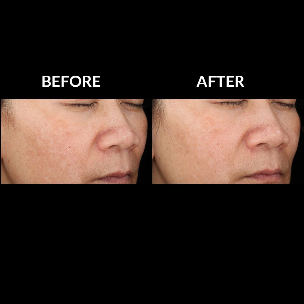 Top SkinMedica Pigment Correcting Serum Reviews for Dark Spots & Melasma