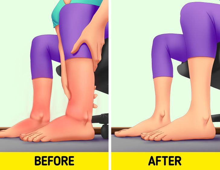 5 Ankle Edema Exercises to Reduce Swelling