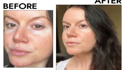 Lilyana Retinol Serum: Glow & Clear Skin Fast