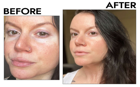 Lilyana Retinol Serum: Glow & Clear Skin Fast