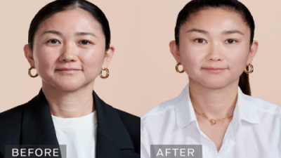 Retinol Before or After Hyaluronic Acid Serum? Find Out Now