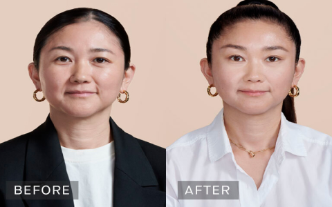 Retinol Before or After Hyaluronic Acid Serum? Find Out Now