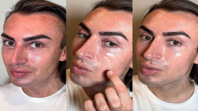 Best Serum for Broken Capillaries on Face: Redness Relief & Skin Soothing Solutions
