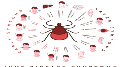 Lyme Disease Exercise Tips: Stay Active Without Pain