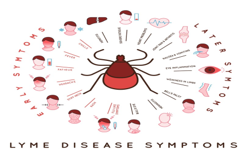 Lyme Disease Exercise Tips: Stay Active Without Pain