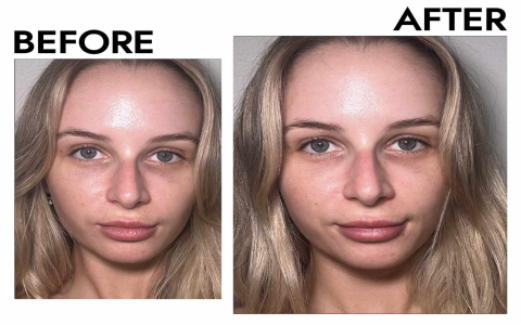 Beauty Lux Eye Corrector Serum – Your Secret to Youthful Eyes