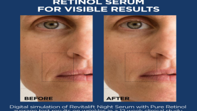 Hyaluronic Acid Serum Before After Results You Need to See