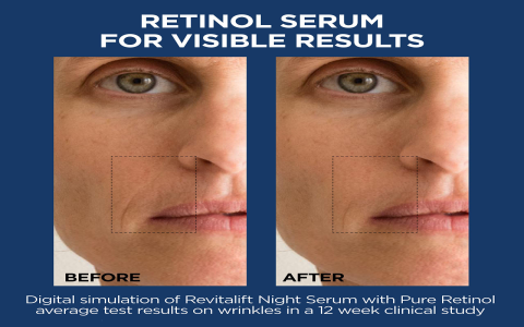 Hyaluronic Acid Serum Before After Results You Need to See