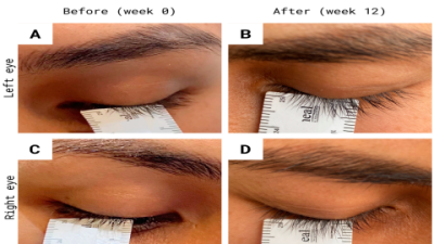Top-Rated Alpha Lash Serum for Eyelash Growth & Volume Boost