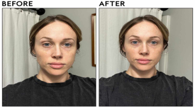 Eye Cream Before or After Serum? The Correct Order Explained