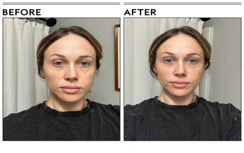 Eye Cream Before or After Serum? The Correct Order Explained