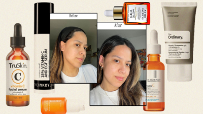 Serum Red Skin: Top Solutions to Calm and Heal Fast
