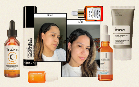Serum Red Skin: Top Solutions to Calm and Heal Fast