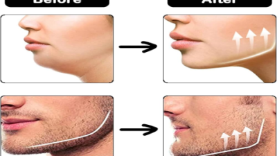 Face Workout Machine: Sculpt Your Perfect Jawline Fast
