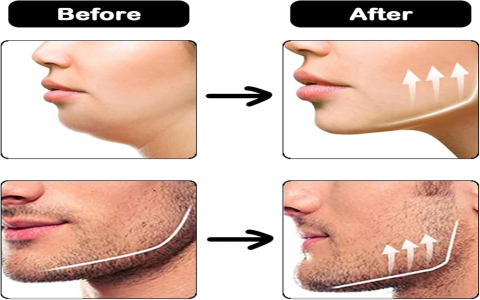 Face Workout Machine: Sculpt Your Perfect Jawline Fast