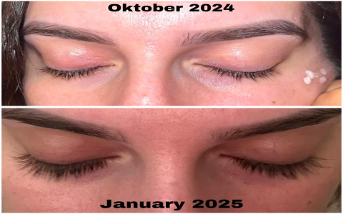 Grande Lash Serum Set: Achieve Fuller Lashes in Weeks
