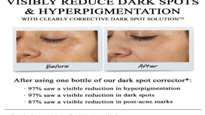 The Brightening Serum Everyone’s Talking About—See Results Fast