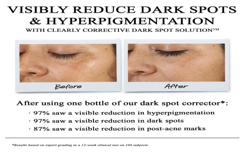 The Brightening Serum Everyone’s Talking About—See Results Fast