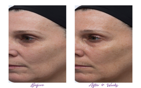 Perricone Eye Serum Results: Your Complete Transformation Timeline