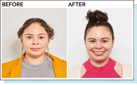 Dark Spots Fade: Vitamin C Serum Before and After Glow