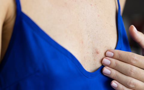 Culprit Bra Alert: 7 Signs Your Bra Is Ruining Your Day