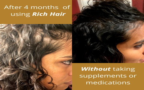 Organic Hair Growth Serum: Get Fuller, Healthier Hair Naturally