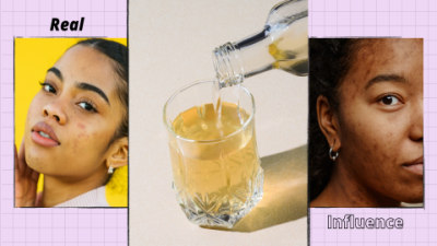 Hyaluronic Acid Serum vs Retinol: Which Wins?