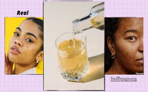 Hyaluronic Acid Serum vs Retinol: Which Wins?