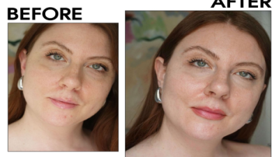 What Is Eye Serum? 5 Shocking Benefits You Must Know
