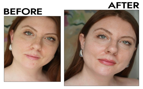 What Is Eye Serum? 5 Shocking Benefits You Must Know