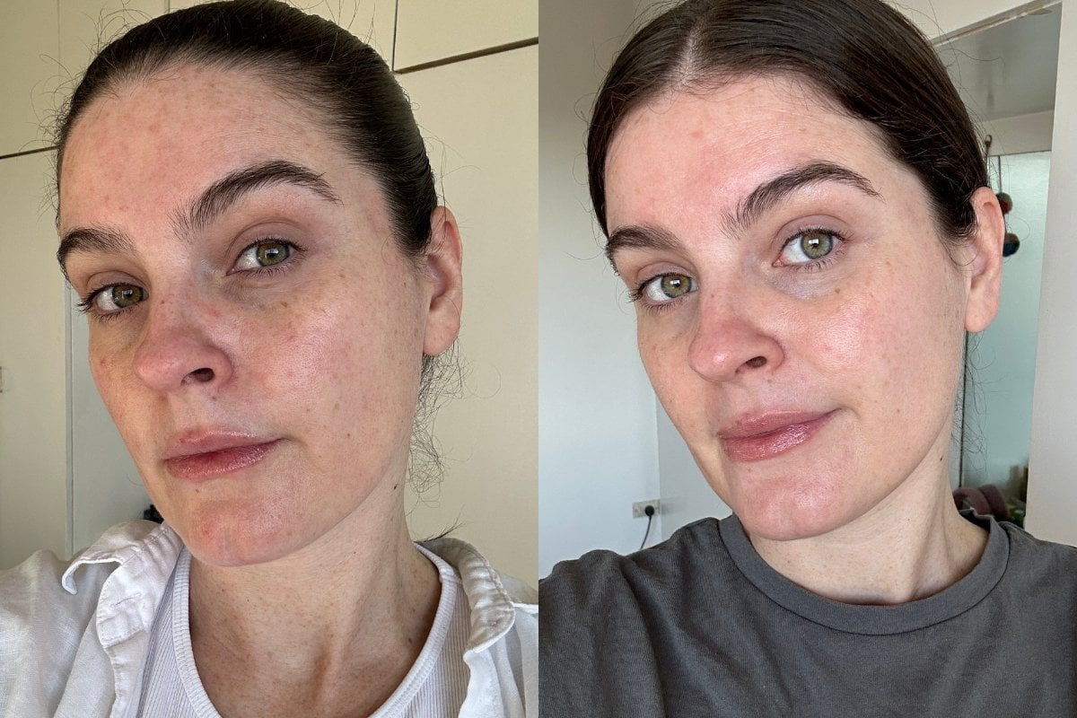 Clarnis Serum Review: Does It Really Transform Your Skin?