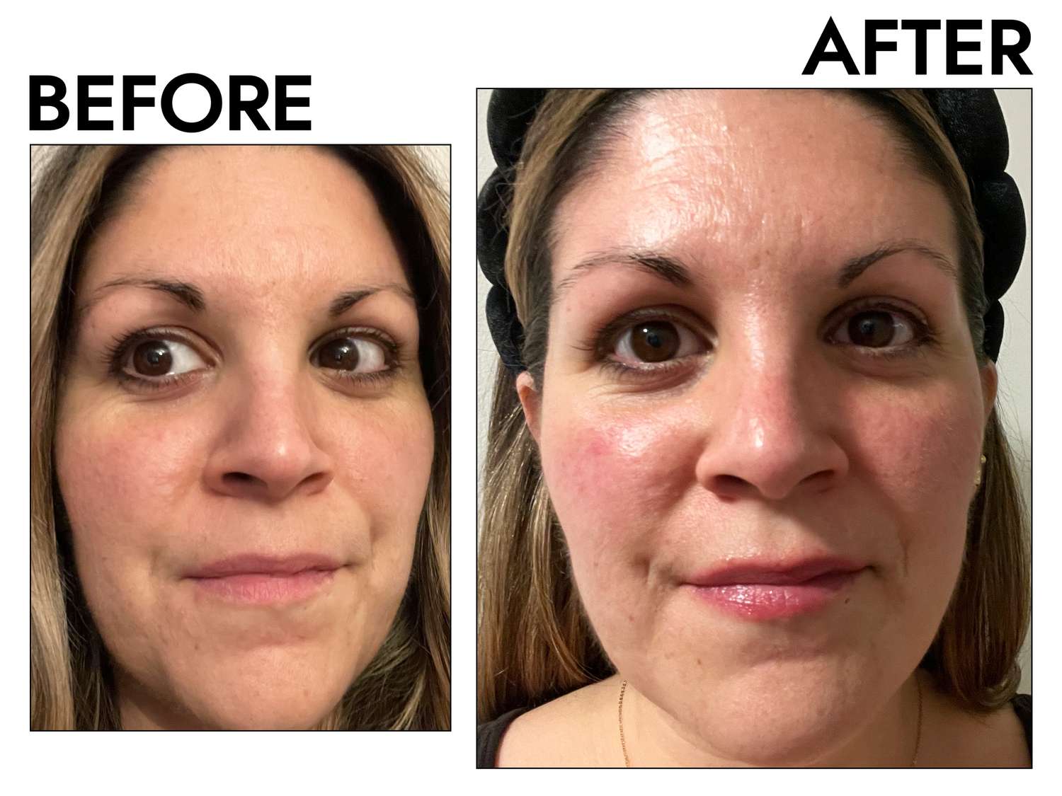 The 7 Best Niacinamide & Retinol Serums That Actually Work (2025 Reviews)