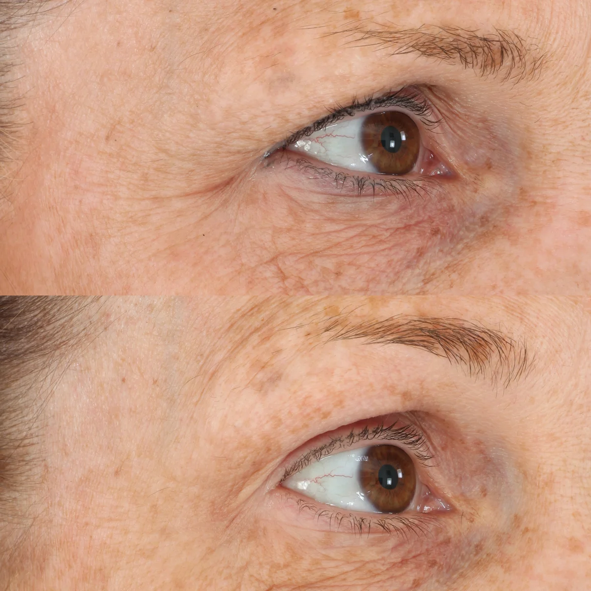 Perricone Eye Serum Results: Your Complete Transformation Timeline