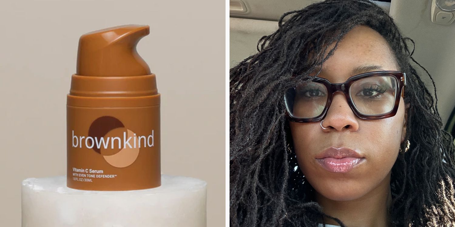 Brownkind Vitamin C Serum Review: Does It Really Work?