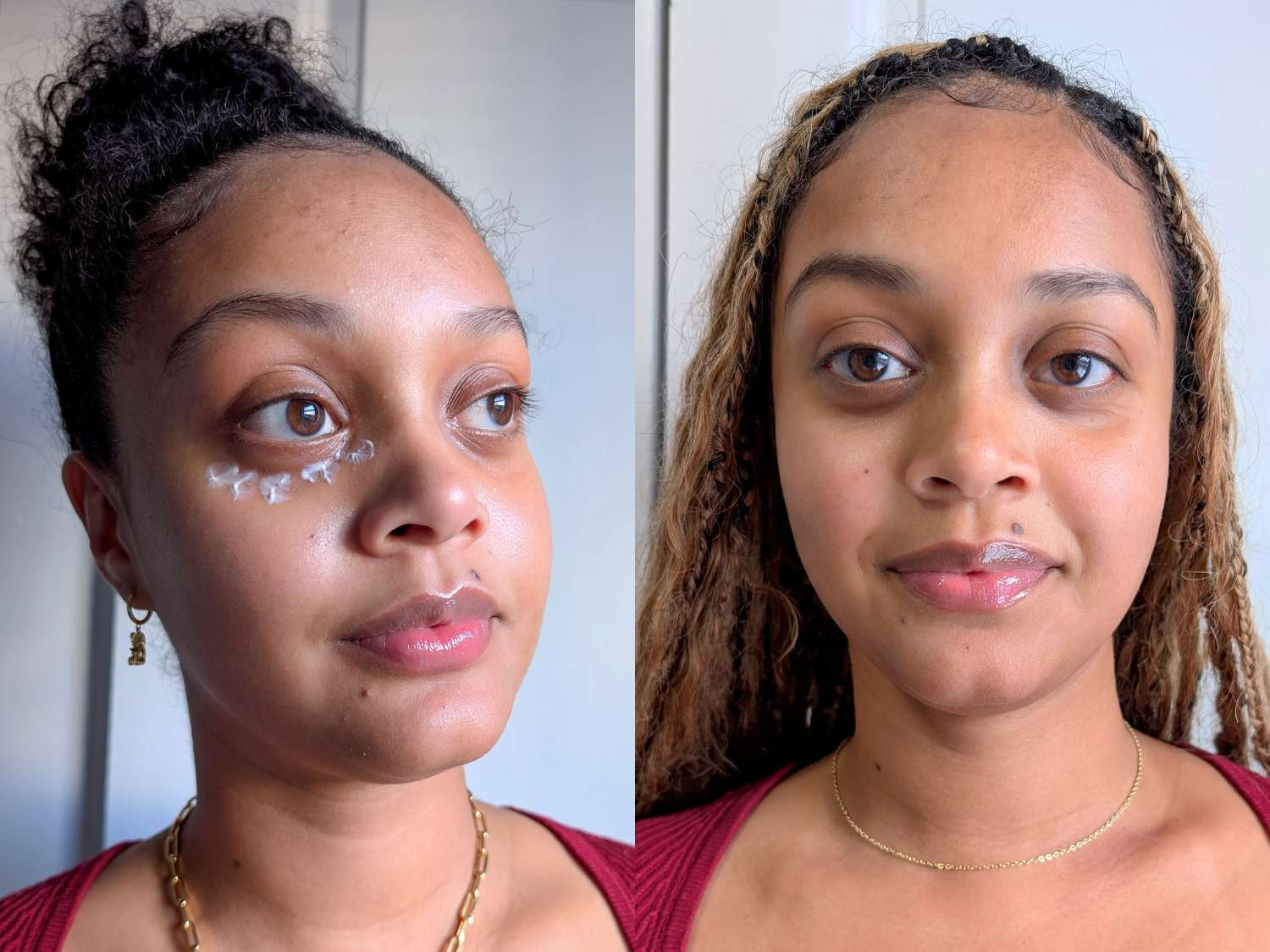 5 Best Eye Circles Serums That Actually Work in 2025